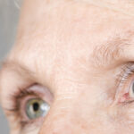 GettyImages75403734commoneyedisorders 1 150x150