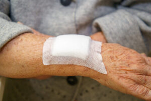 wound healding Acare